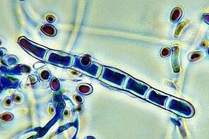 agente patogeno del fungo del chiodo al microscopio