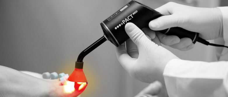 trattamento laser per funghi sulle unghie dei piedi